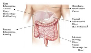 Introducing the Gastrointestinal Consequences of Substance Abuse